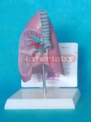 MIX TYPE ANATOMICAL TRACHEA / LUNG MODEL WITH DESCRIPTION PLATE